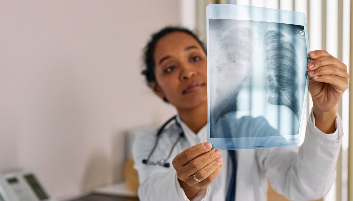 A doctor examining a chest X-ray on a light box