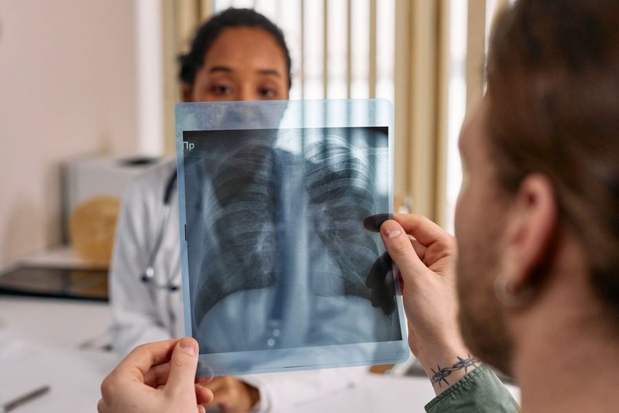 Tuberculosis — TB treatment in Rewari
